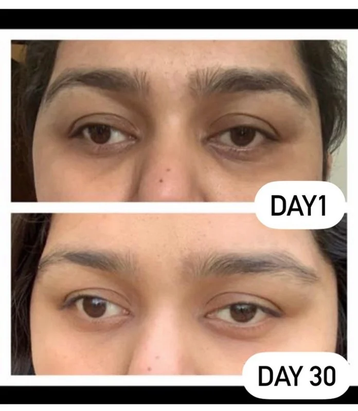 Face yoga client transformation 6