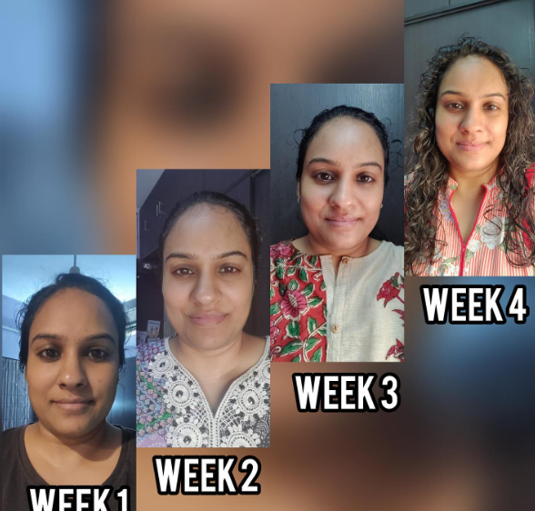 Face yoga client transformation 7