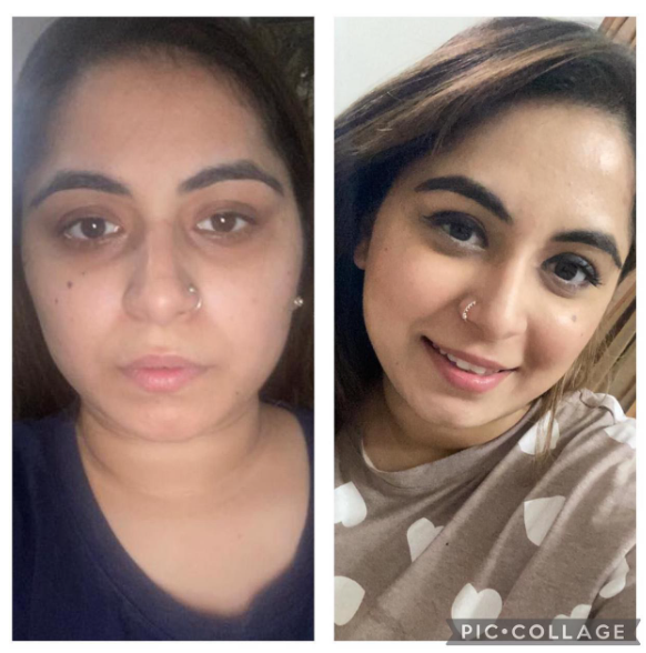 Face yoga client transformation 8