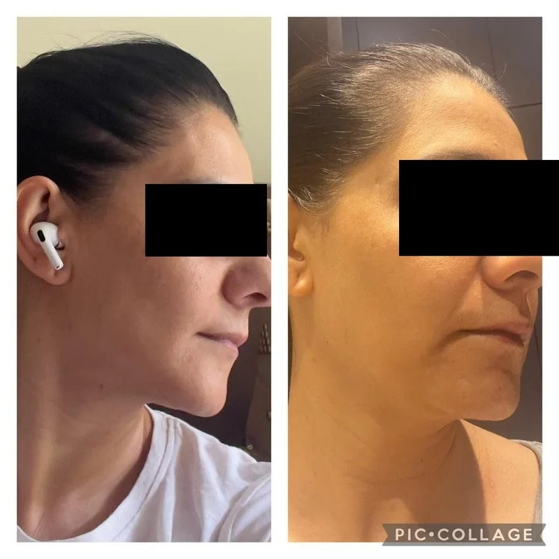 Face yoga client transformation 10